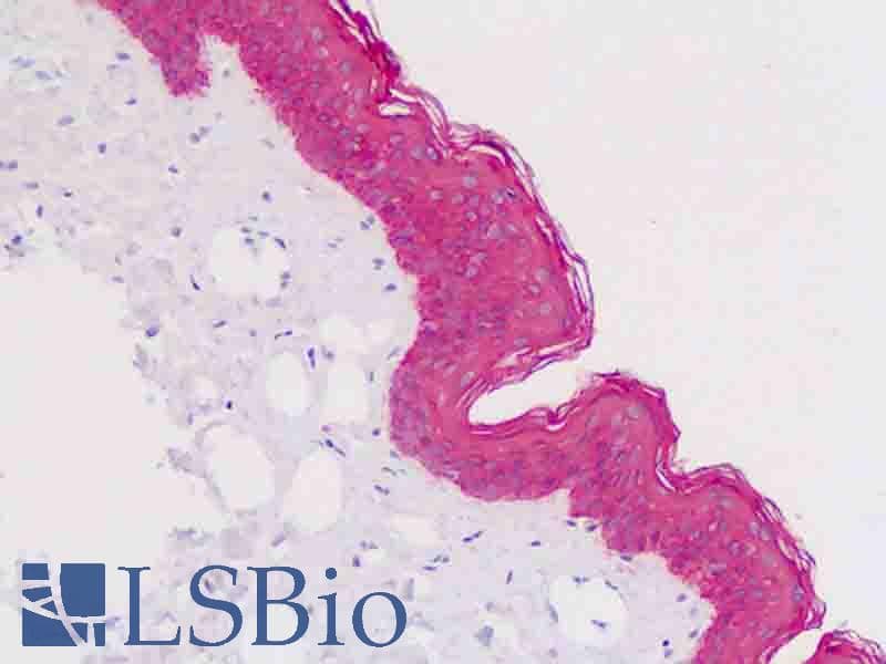 PathPlus™ KRT5 / CK5 / Cytokeratin 5 Antibody (aa158-272, clone 2C2)