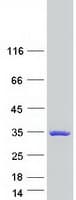 Human TTC9 Protein (Recombinant Myc-DDK (Flag))