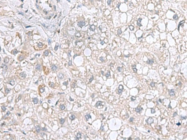 Polyclonal Rabbit anti-Human STK32A Antibody (IHC, WB)