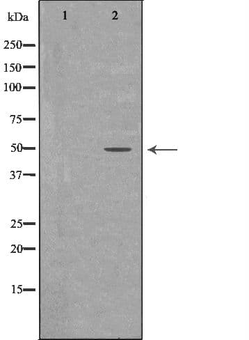 PTPN2 / TC-PTP Antibody
