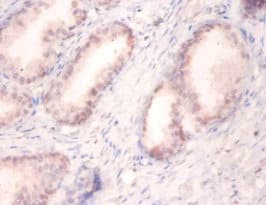 Polyclonal Rabbit anti-Human SNRPA / U1A Antibody (IHC, WB)