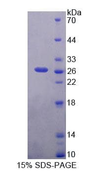 Human PCM1 Protein (Recombinant His-T7)