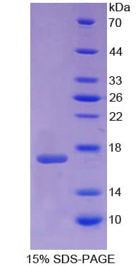 Mouse GDNF Protein (Recombinant His)