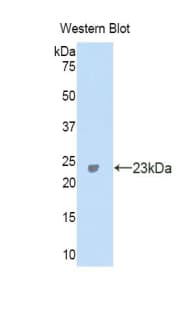 CA5A / Carbonic Anhydrase VA Antibody (aa7-179)