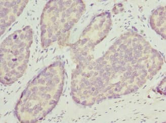 Polyclonal Rabbit anti-Human OPHN1 Antibody (IHC, WB)