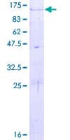 Human ADAM32 Protein (Recombinant GST)