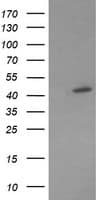 MAP2K1 / MKK1 / MEK1 Antibody (clone OTI2F1)