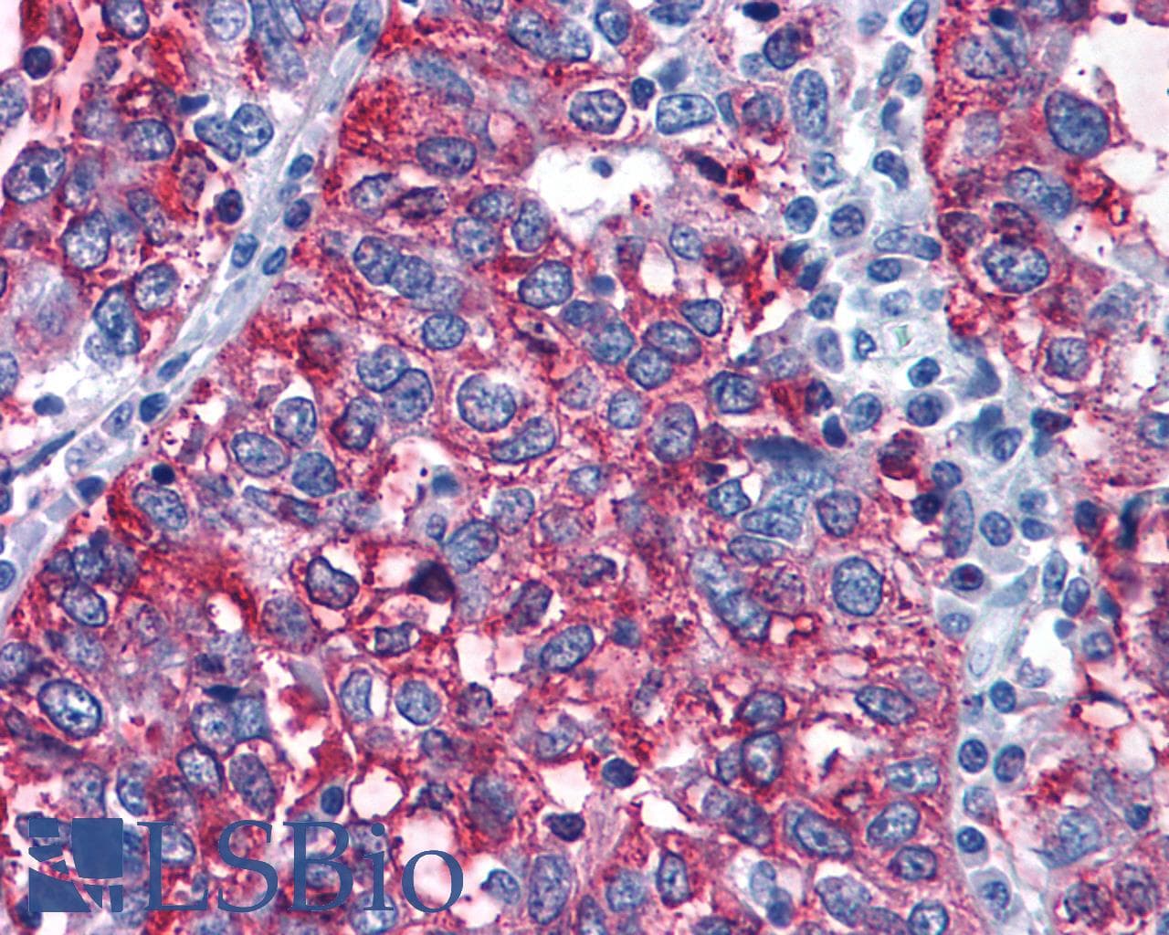 PathPlus™ GPR108 Antibody (Cytoplasmic Domain)