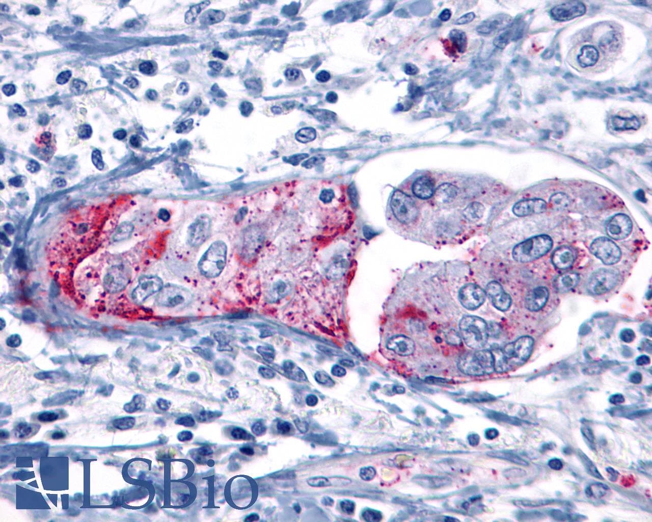 PathPlus™ GRM8 / MGLUR8 Antibody (C-Terminus)