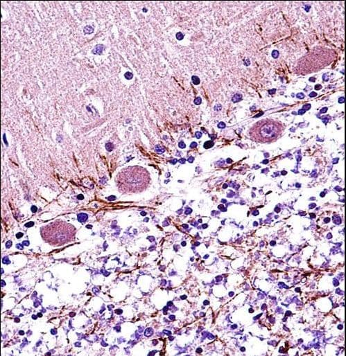 Polyclonal Rabbit anti-Human RARA / RAR Alpha Antibody (aa322-349, IHC, IF, WB)