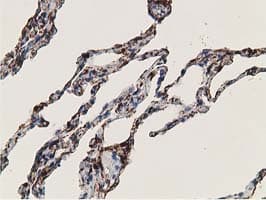 ADH2 / ADH1B Antibody (clone OTI5D7)