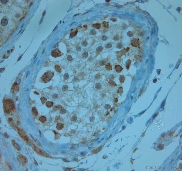 KCNJ13 / KIR7.1 Antibody (aa2-50)