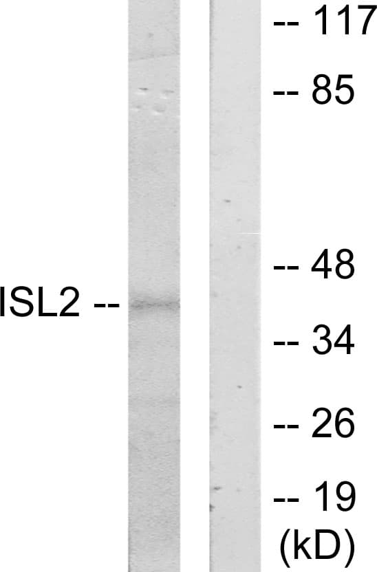 ISL2 / Islet 2 Antibody (aa161-210)