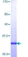 Human BLM Protein (Recombinant GST, N-terminus)