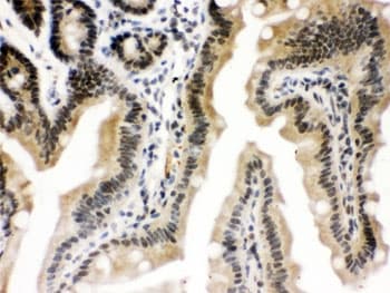 CTCF Antibody