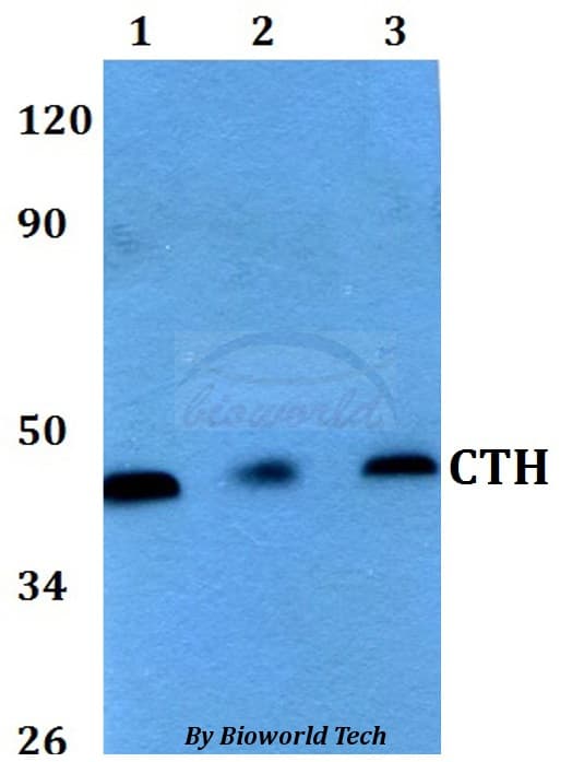CTH / Cystathionase Antibody