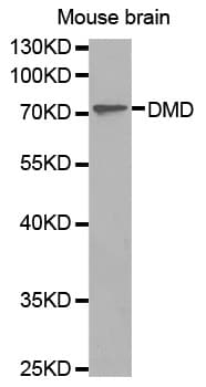 IHC-plus™ Polyclonal Rabbit anti-Human DMD / Dystrophin Antibody (IHC, WB)