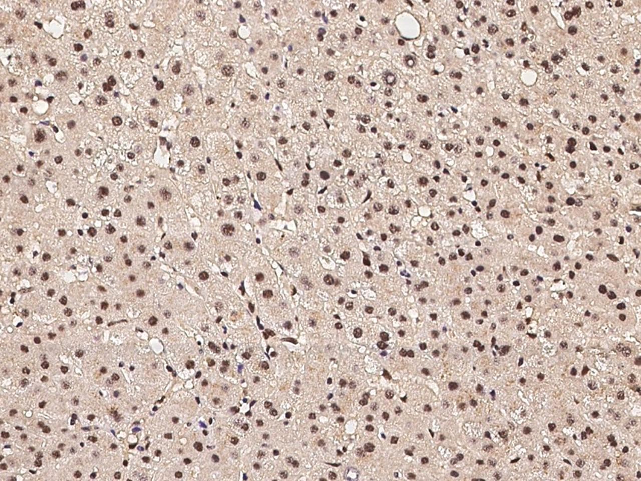 Polyclonal Rabbit anti-Human CASP5 / Caspase 5 Antibody (IHC)