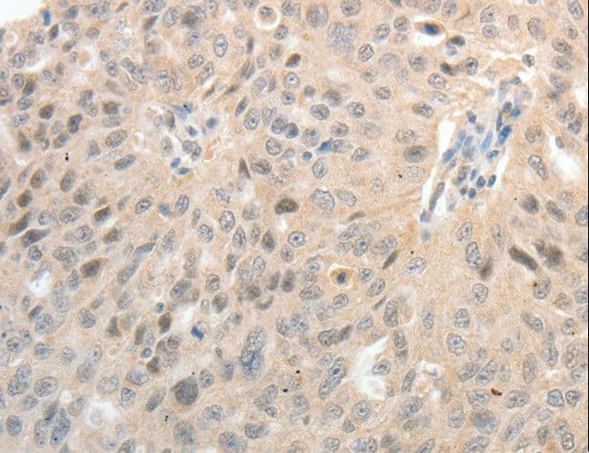 ASCL1 / MASH1 Antibody