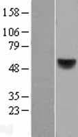 RARB / RAR Beta Protein (Over-Expression Lysate Myc-DDK (Flag))