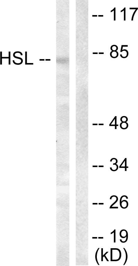 LIPE / HSL Antibody (p554)