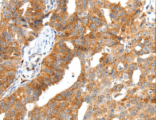 Polyclonal Rabbit anti-Human Secretin Antibody (IHC)