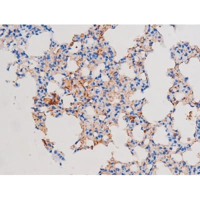 IRS1 Antibody (phospho-Ser639)