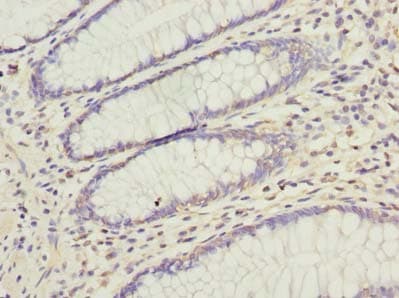 Polyclonal Rabbit anti-Human CFLAR / FLIP Antibody (IHC, WB)