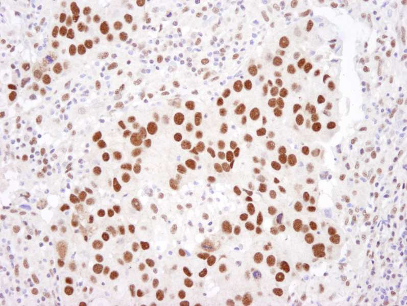 HDAC2 Antibody (aa425-C-term)