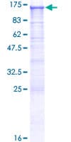 Human DSC2 / Desmocollin 2 Protein (Recombinant GST)