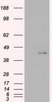 KRT19 / CK19 / Cytokeratin 19 Antibody (clone OTI2F8)