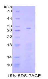 Human ADCY3 / Adenylate Cyclase 3 Protein (Recombinant His-T7)