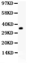 GNB2L1 / RACK1 Antibody (aa2-317)