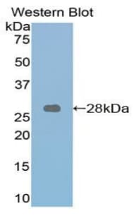 RARA / RAR Alpha Antibody (aa237-459, FITC)