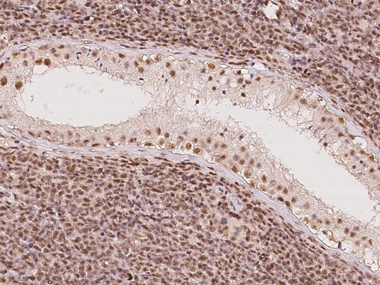 DDX46 Antibody