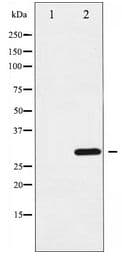 CCND3 / Cyclin D3 Antibody