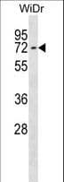 Polyclonal Rabbit anti-Human CTNNBL1 / NAP Antibody (aa16-43, WB)
