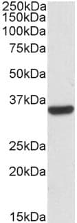 IHC-plus™ CNN2 Antibody (aa292-306)