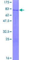 Human ZNF621 Protein (Recombinant GST)