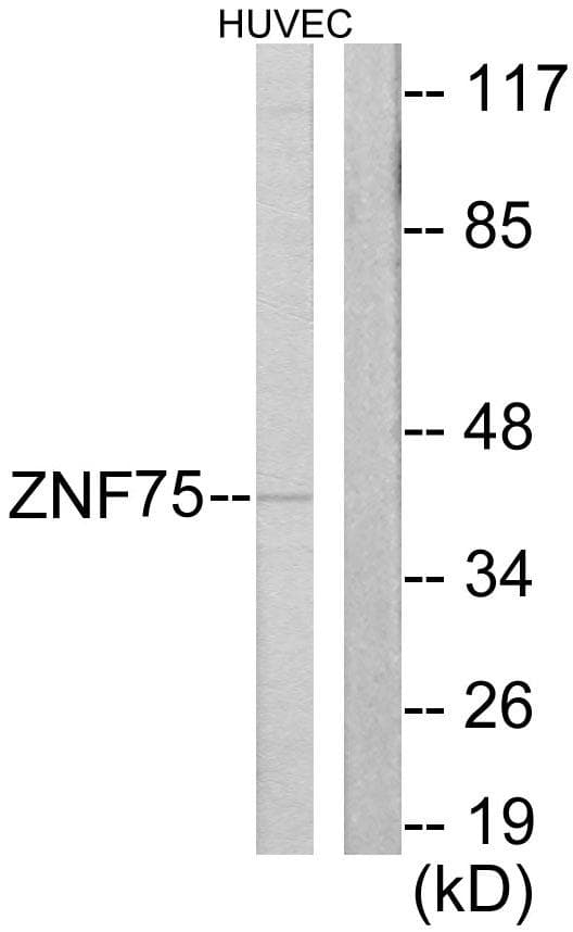 Polyclonal Rabbit anti-Human ZNF75 / ZNF75D Antibody (WB)