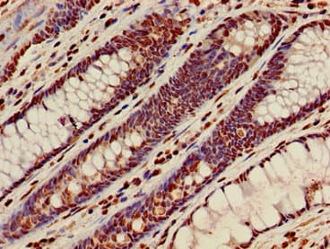 HIST1H3A Antibody