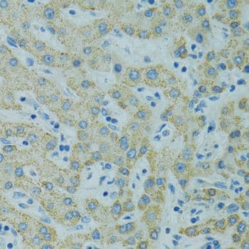 Polyclonal Rabbit anti-Human STX1A / Syntaxin 1A Antibody (IHC, WB)