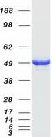 Human ADSS Protein (Recombinant Myc-DDK (Flag))