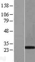 PHOX2B Protein (Over-Expression Lysate Myc-DDK (Flag))