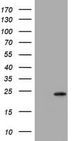 VILIP / VSNL1 Antibody (clone OTI4A6)