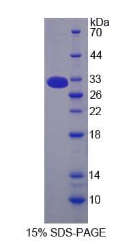 Mouse MBL2 / Mannose Binding Protein (Recombinant His-S)