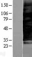 SCAMP3 Protein (Over-Expression Lysate Myc-DDK (Flag))