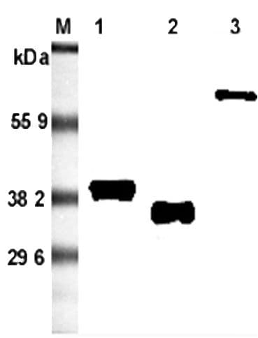 Monoclonal Mouse anti-Rat Adiponectin Antibody (clone RADI 264, WB)