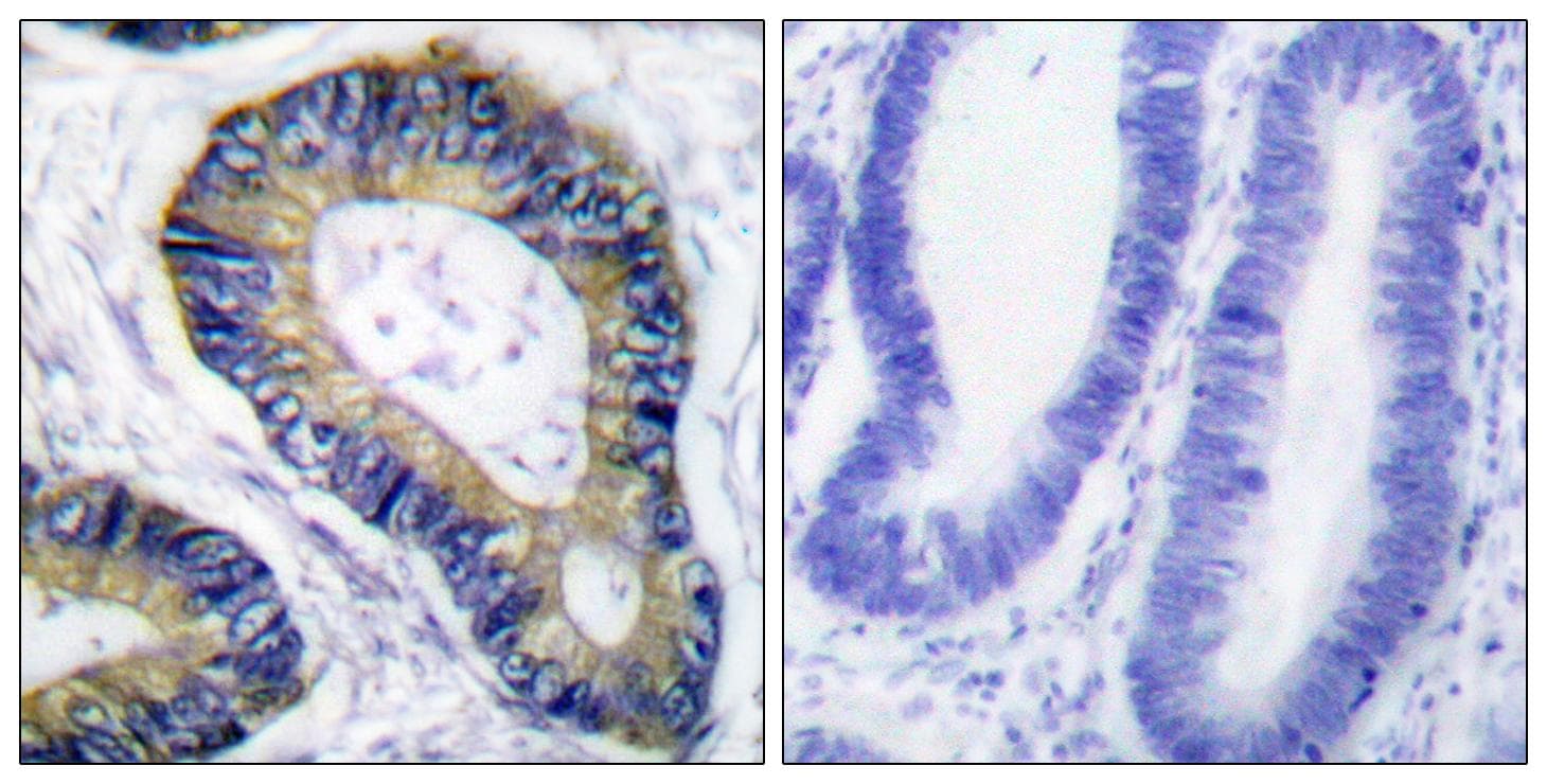EIF4EBP1 / 4EBP1 Antibody (p69)
