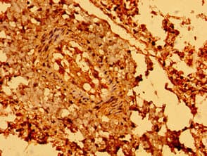 SEMA5B / Semaphorin 5B Antibody